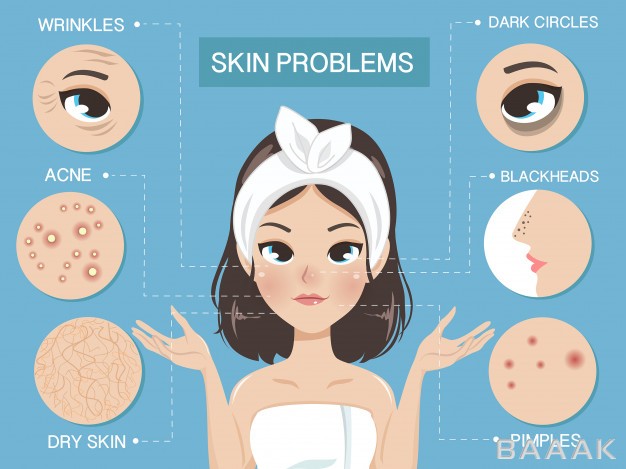 اینفوگرافیک-خلاقانه-Problem-skin-infographic-by-beautiful-girl_4734448