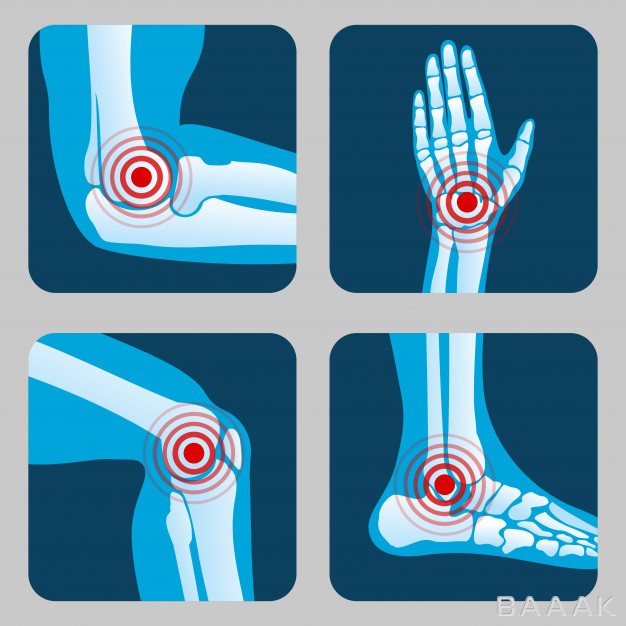 اینفوگرافیک-خلاقانه-Human-joints-with-pain-rings-arthritis-rheumatism-infographic-medical-app-vector-buttons_5251802